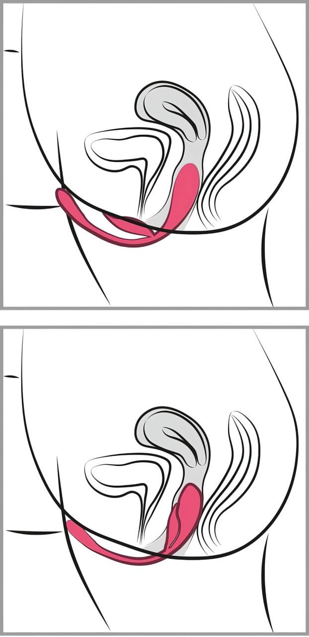 SMILE - akkus, rádiós vibrációs tojás (pink) SMILE - akkus, rádiós vibrációs tojás (pink)