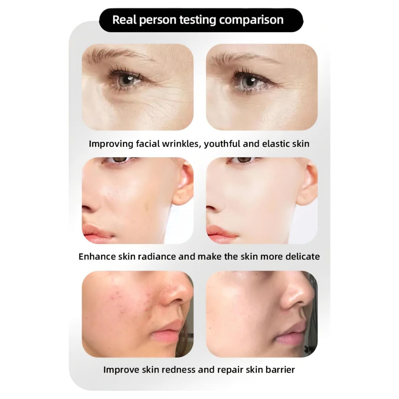 Photon Rejuvenation Arcápoló LED maszk Photon Rejuvenation Arcápoló LED maszk