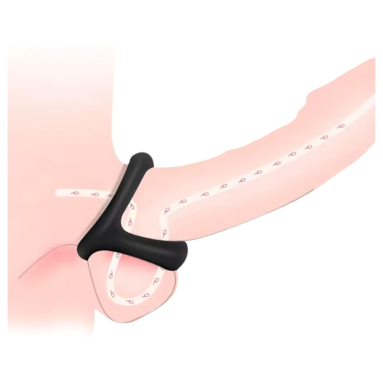 Pénisz- és heregyűrű pontozott felszínnel (fekete) Pénisz- és heregyűrű pontozott felszínnel (fekete)