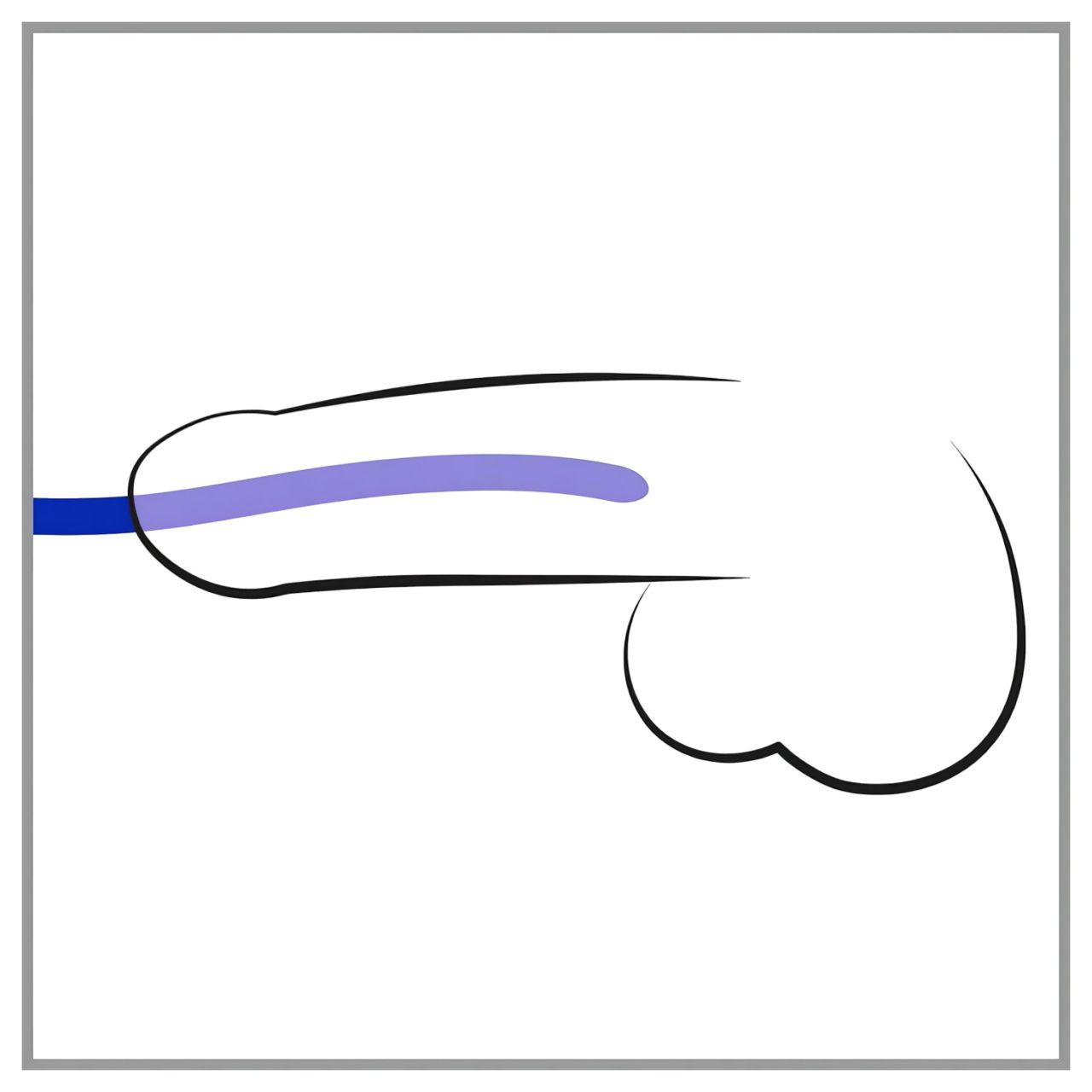 You2Toys - DILATOR - szilikon dilátor szett (3 db)